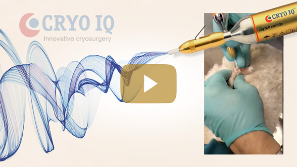 Using CryoIQ PRO cryo pen with D3 tip, treating multiple cutaneous papilloma