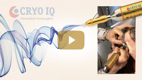 Using CryoIQ PRO cryo pen with D3 tip, treating multiple skin lesions