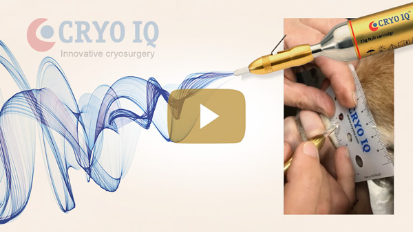 Using CryoIQ PRO cryo pen with D3 tip, treating papilloma lesion close to the eye